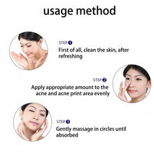 Load image into Gallery viewer, 3x 30g Acne Removal Cream Blackhead Treatment Oil Control Shrink Pores Whitening

